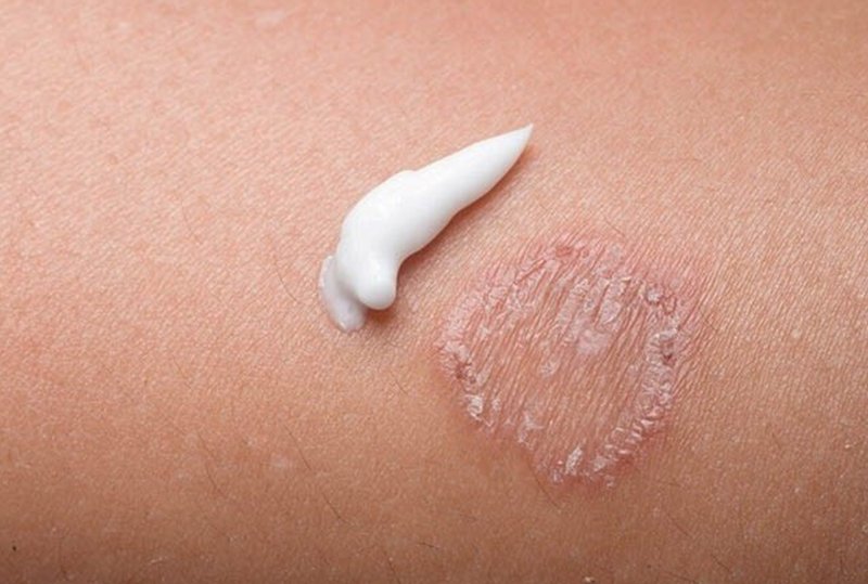 Tổng quan về các bệnh lý Nội tiết